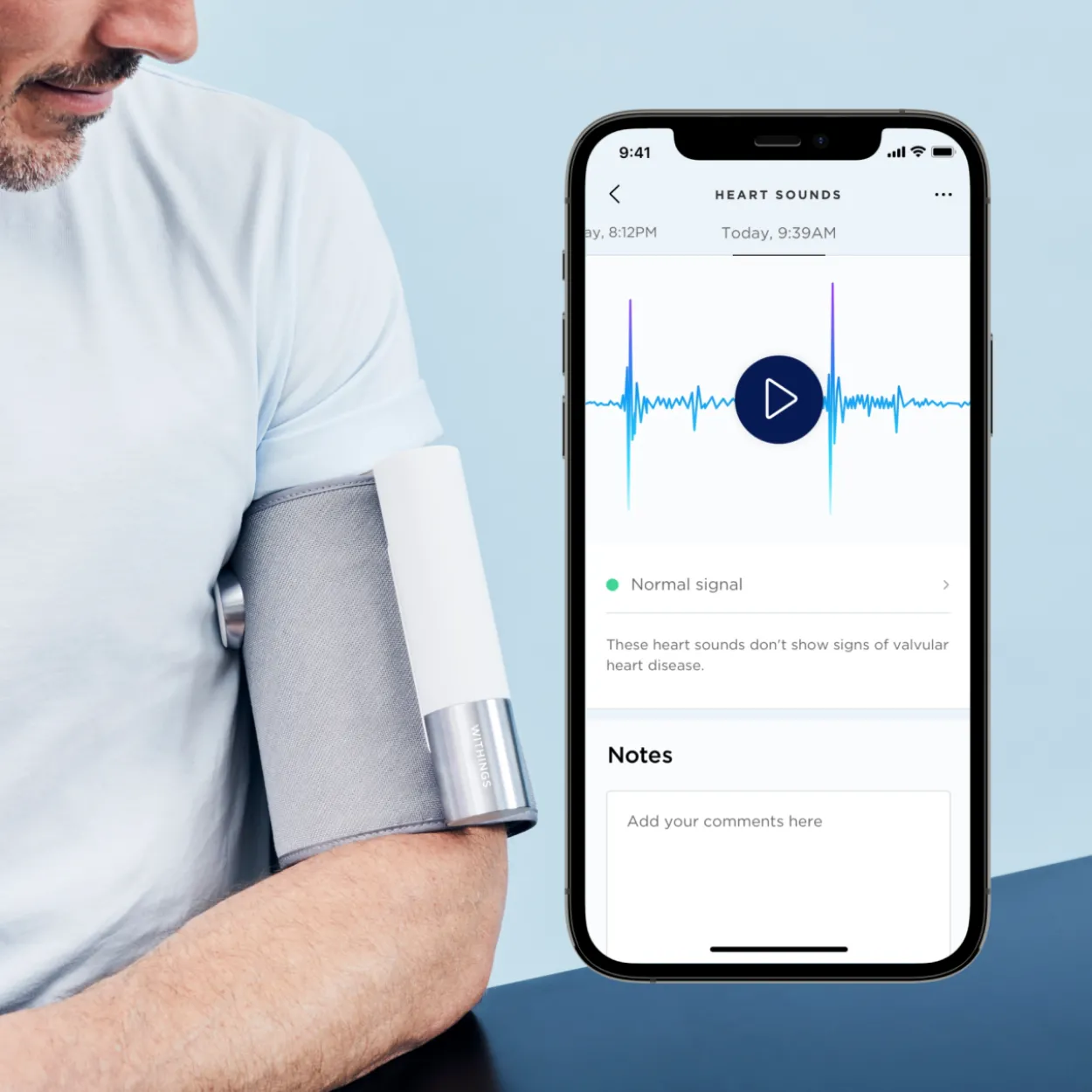 Verenpainemittari Withings BPM Core